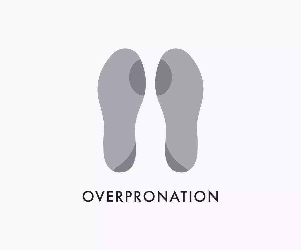 Over Pronation Example