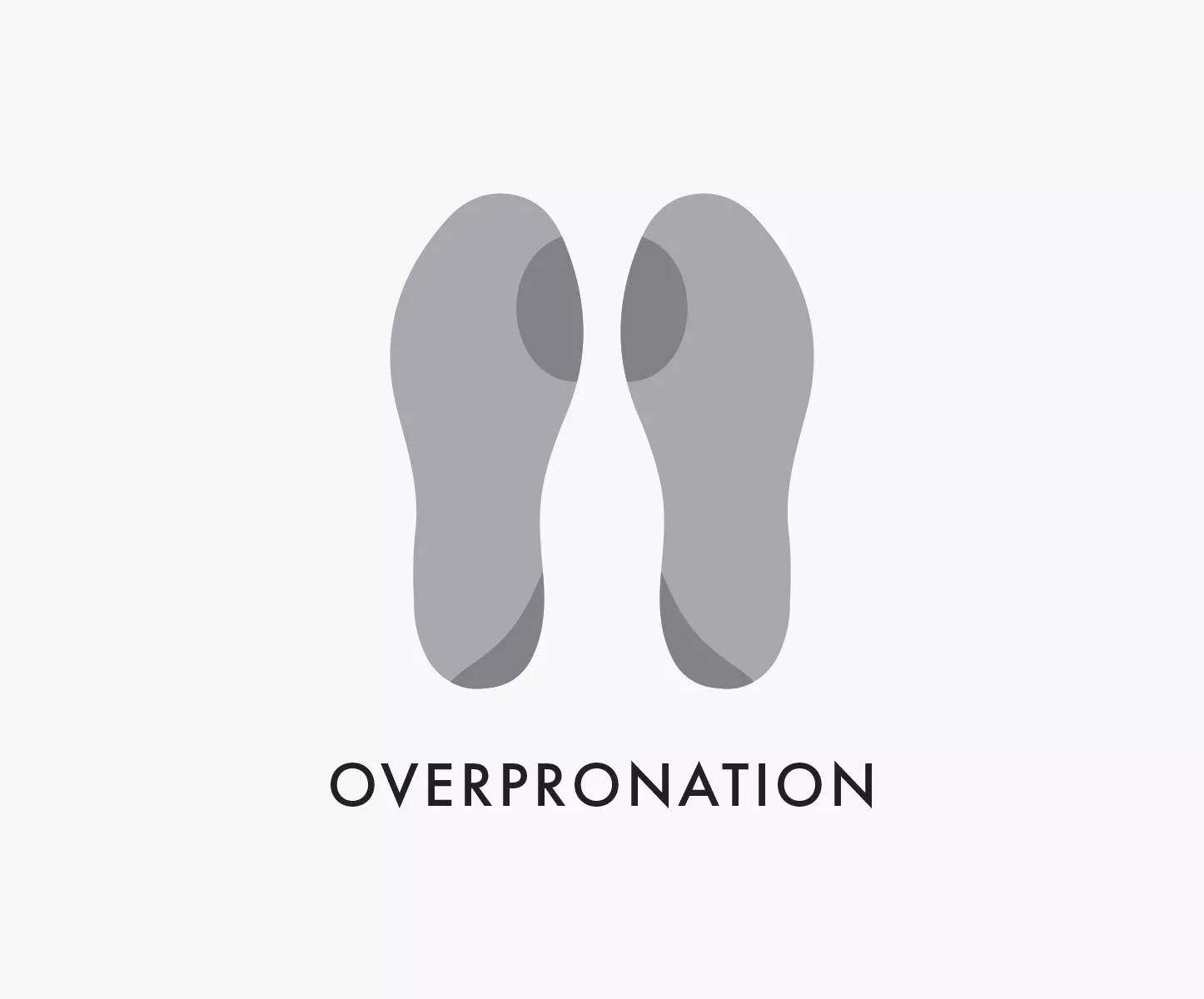 Over Pronation Example